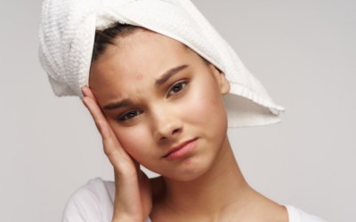 Getting Rid Of Acne Once And For All